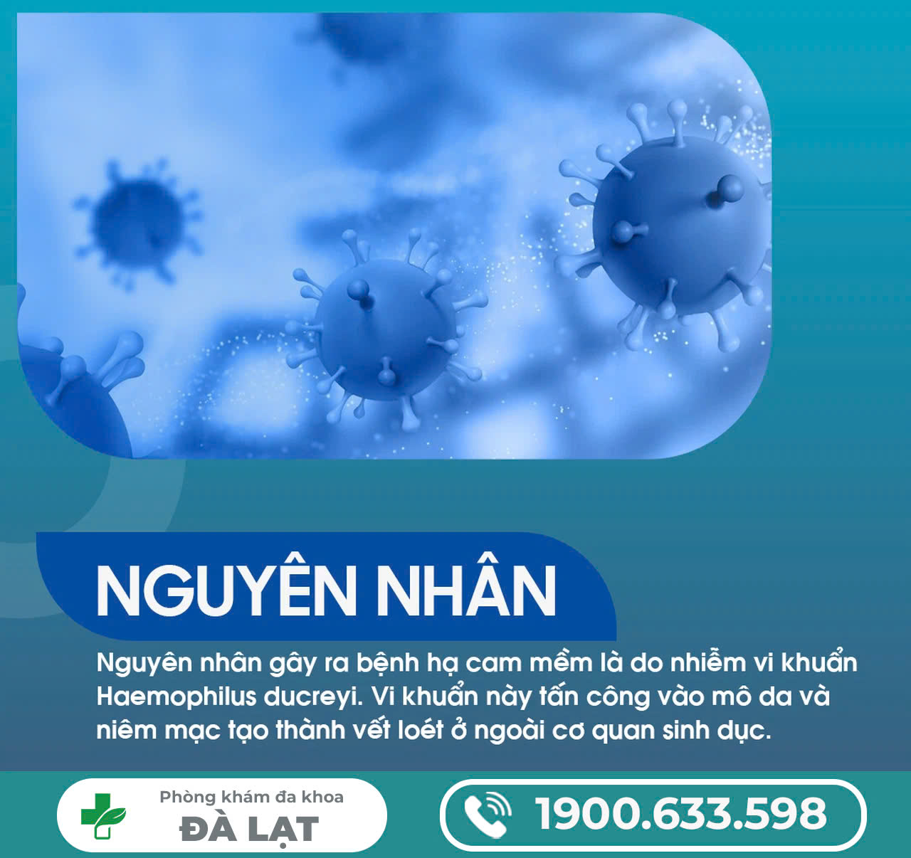 Hình ảnh minh họa